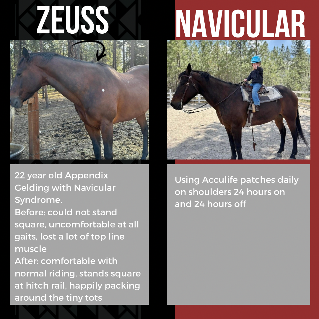 Zeuss - Navicular phototherapy success story
